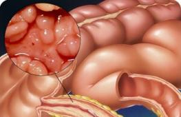 Gastrointestinal diseases: causes, symptoms, treatment, diet and prevention